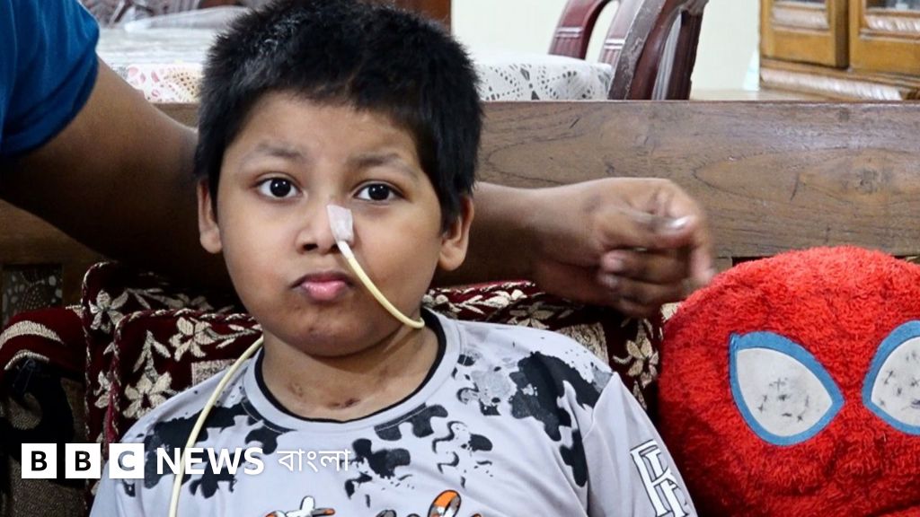জুলাই আন্দোলনে আহত শিশুদের দীর্ঘস্থায়ী ক্ষত