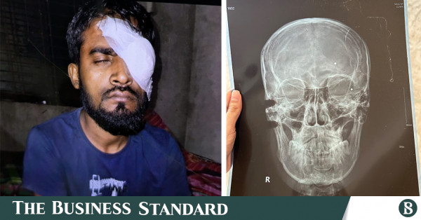 প্রতিবাদকারীদের দৃষ্টিশক্তি কেড়ে নেওয়া: বাংলাদেশ থেকে গাজা, কেন দমনমূলক শাসনব্যবস্থা এমন কৌশল বেছে নেয়