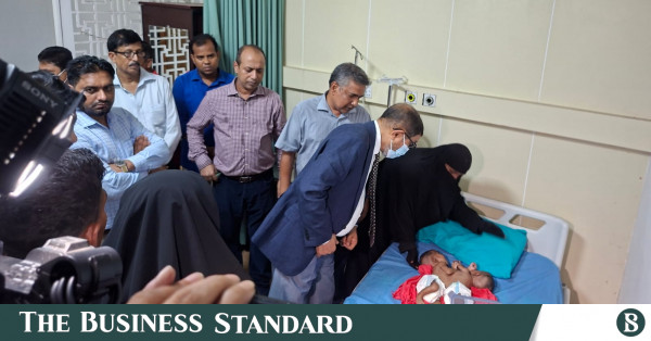 জোড়া লাগানো যমজ শিশুদের চিকিৎসার ব্যয়ভার বহন করবে সরকার